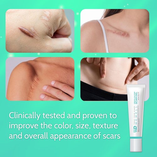 Scar Cream for Keloid Bump Removal: Professional Silicone Gel for Keloids, Acne Scars, Stretch Marks, C-Section & Burn Marks – Old & New Scar Care Treatment, 1 oz