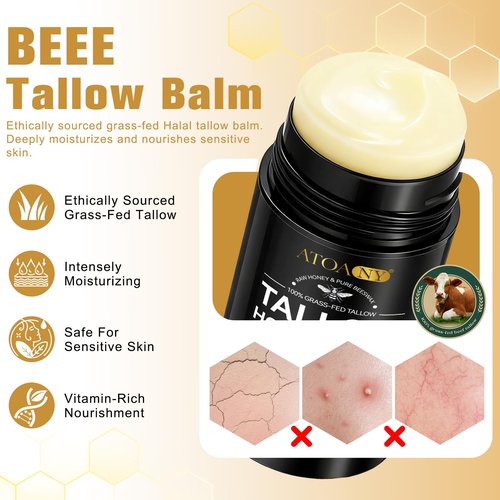NIFEISHI Organic Beef Tallow for Skin, 100% Grass Fed Beef Tallow and Honey Balm Stick for Face and Body, Tallow face Moisturizer for Dry and Sensitive Skin, Natural Formula - 2.6 FLoz