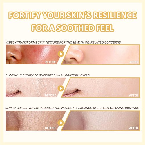 FOR SADOER Rice Niacinamide Skincare Set - 6 Piece Firming Skincare Kit with Cleanser, Toner, Lotion, Eye Cream, Face Cream & Serum for Daily Facial Care