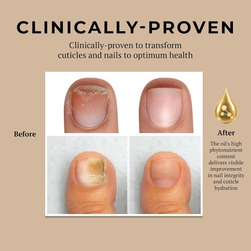 Miracle Fruit Oil Nail Strengthener - Intense Moisture & Protection for Thin Nails | 10ml Cuticle Oil
