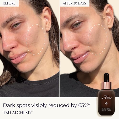 Tru Alchemy Vitamin C Glow Serum - Hydrating Anti-Aging Face Serum with Bakuchiol & Acids | 1 fl oz