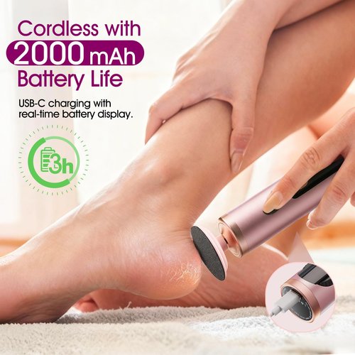 Electric Foot Callus Remover Rechargeable, Professional Pedicure Tools for Feet with 40PCS Sandpaper Discs, Adjustable Speed Heel Scraper for Cracked Heels, Foot Care Scrubber File for Dry Dead Skin