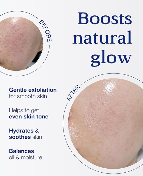 Nuborn Cell Oasis Pad - Korean Toner Pads with Stem Cell Serum & PHA | Hydrating 160ml, 70 Soft Pads for Glowing Skin