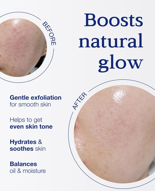 BLANC DUBU Nuborn Cell Oasis Pad | Korean Skin Care Toner Pads with Stem Cell Serum & PHA | Hydrating Face Cleansing Pads for Glowing Skin 160ml 70 Soft Pads
