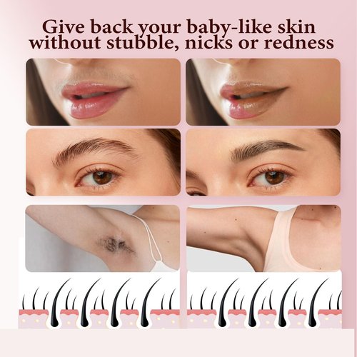 Gurelax Replacement Heads for Flawless Finishing Touch Facial Hair Remover, Gen 3 Replacement Blades for Women,18K Gold Replacement Blades Refill (Just fit for Gen3 Device)