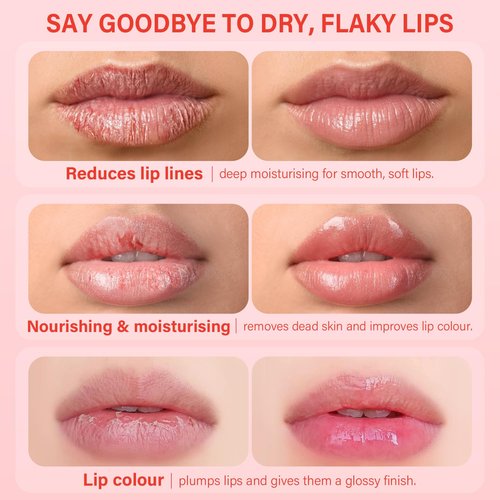Skiennix Lip Mask Set - 4 Pcs Overnight Lip Care Gift for Women & Teens | Hydrating Shea Butter & Vitamin C