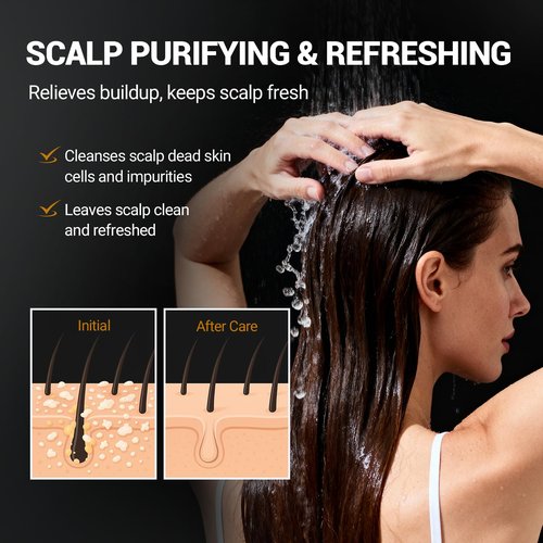 Face, Body & Scalp Scrub, 3-in-1 Gentle Microdermabrasion Exfoliating Scrub with Niacinamide & Vitamin C, Deep Cleansing, Oil Control, Dead Skin Removal, Pore-Refining for Smooth Radiant Skin, 12.3 oz