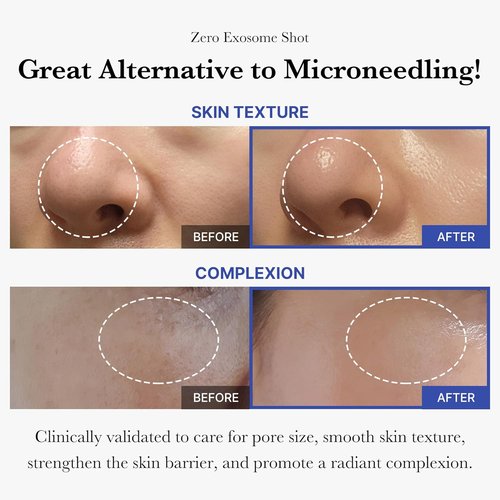 Medicube Flawless Skin - Deep Vitamin C Golden Capsule Moisturizer & 7,500 PPM Exosome Serum