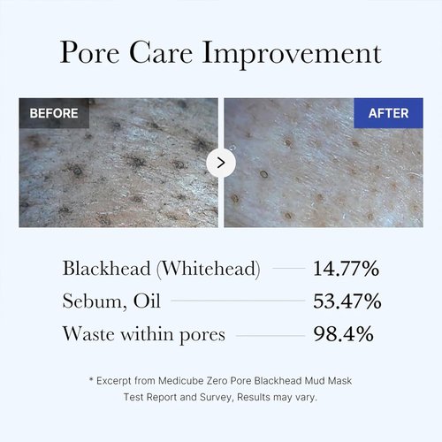 Medicube Zero Pore Blackhead Mud Facial Mask - Cooling & Pore Tightening - Quick Dry AHA/BHA/PHA Formula - 3.52 oz