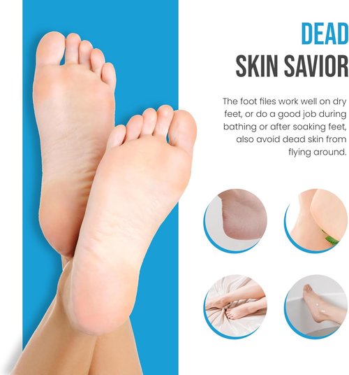 Krisp Beauty Foot Rasp - Professional 7” Callus Remover & Pumice Tool for Smooth Feet | Wet/Dry Use