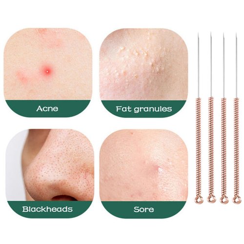 110 pcs Disposable Pimple Needles Acne Needle Blackhead and Blemish Remover Tools, Pimple Popper Tools Professional（Gold）