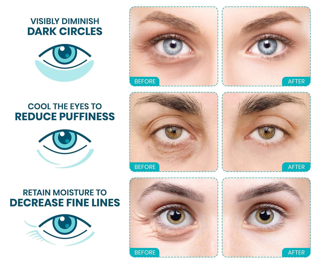 Stylia Under Eye Patches - Collagen & Vitamin C for Puffy Eyes | Hydrating & Firming Mask (30 Pairs)