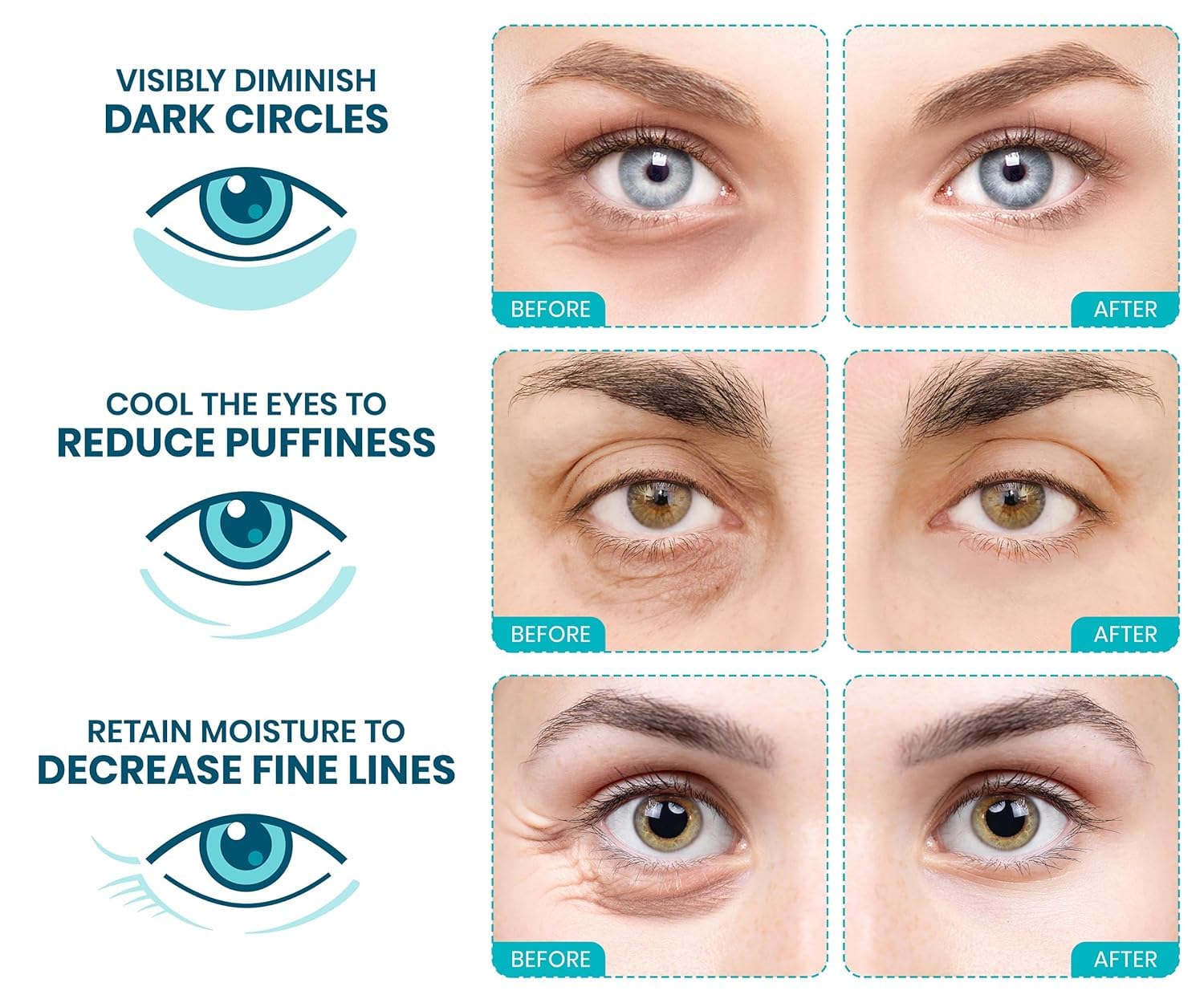 Stylia Under Eye Patches - Collagen & Vitamin C for Puffy Eyes | Hydrating & Firming Mask (30 Pairs)