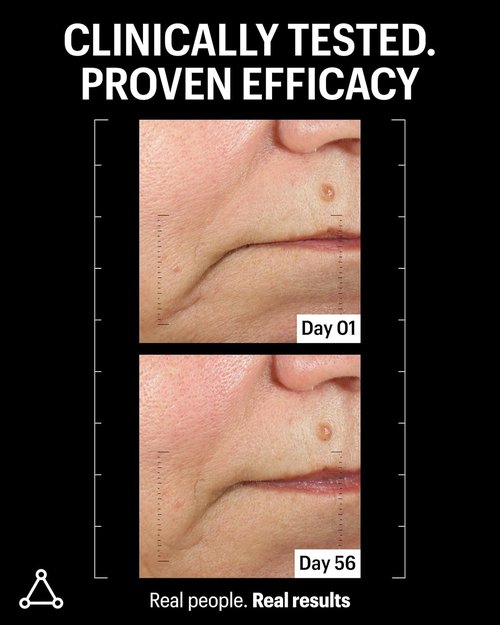Allies of Skin Advanced Firming Daily Treatment - 13 Brighteners, 9 Antioxidants, 48ml