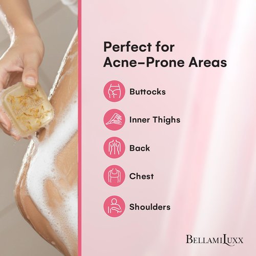BellamiLuxx Body Acne Soap Bar: Antibacterial Bar for Butt, Thighs, Back, Body Acne, Folliculitis & Fungal Prone Skin - Tea Tree Oil, Sulfur & Salicylic Acid Soap - Reduce Bumps, Clogged Pores