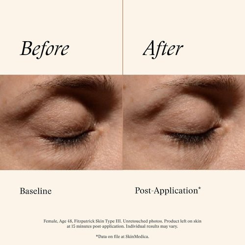 SkinMedica Instant Bright Eye Cream - Age-Defying Formula for Dark Circles, Puffiness & Lines