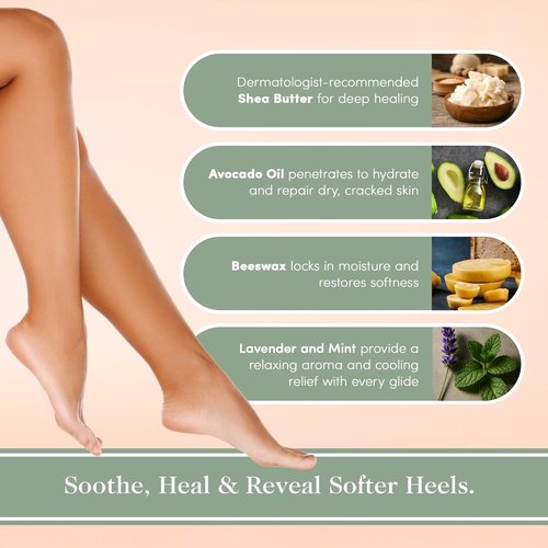 Victoria's Lavender Heel Balm Stick - Ultra-Rich Therapy for Dry, Cracked Feet - Lavender Mint 2.5oz