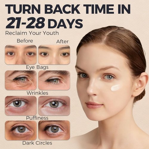Regine Switzerland Retinol Under Eye Cream - Anti-Aging Formula for Dark Circles & Puffiness | 0.7 Fl. Oz