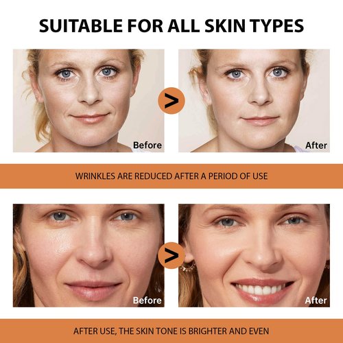 VGO Vitamin C Serum for Face, Vit C Anti Aging Serum with Hyaluronic Acid & Vitamina E, Deep Hydration Facial Care for All Skin Types, 1.01oz / 30ml