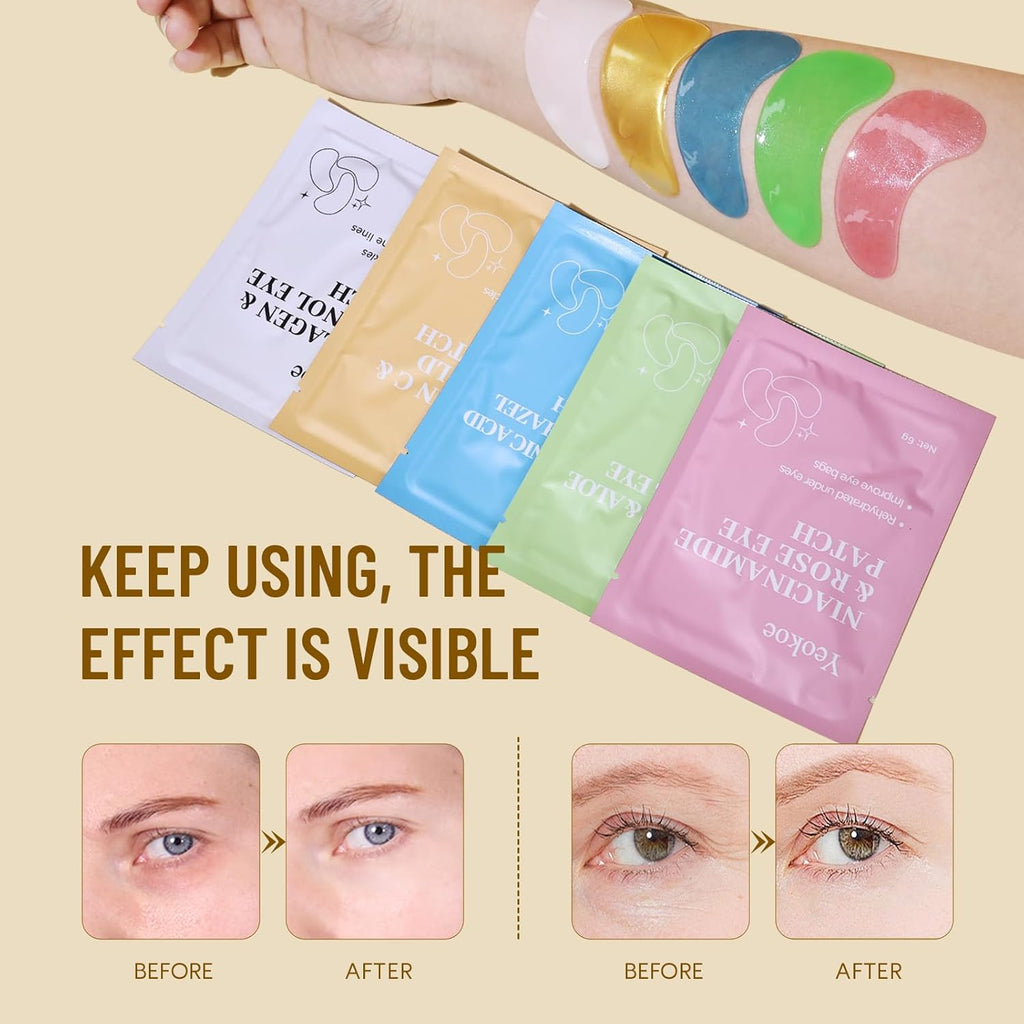 Yeokoe Under Eye Patches - Collagen & Retinol Eye Masks for Dark Circles | 20 Pairs