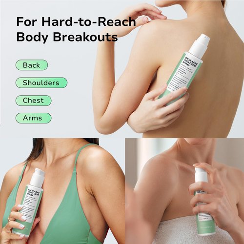 BellamiLuxx Back and Body Acne Treatment Spray: 2% Salicylic Acid & Tea Tree Oil Bacne Spray for Clear, Soothe & Moisturize - Effective for Men, Women, Teens with Back, Shoulder, Arm, and Chest Acne