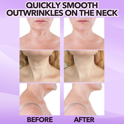 Bocello 20PCS Neck Tape Lifting Invisible, Neck Lift Tape, Reusable Face Lifting Tape Invisible, High Elastic Strips for Double Chin Ne-ck Jowls, Improve Ne-ck Lines and Wrinkles