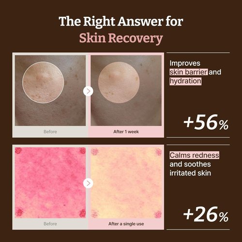 Dr. Reju-All PDRN Rejuvenating Cream - 1200ppm Face Moisturizer for Glass Skin & Plumping - 0.7 Fl Oz