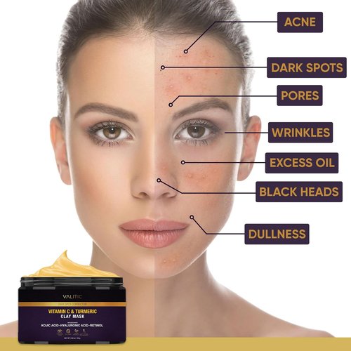 VALITIC Vitamin C & Turmeric Clay Mask - Dark Spot Corrector with Kojic Acid & Retinol - 100g Skin Care Essential