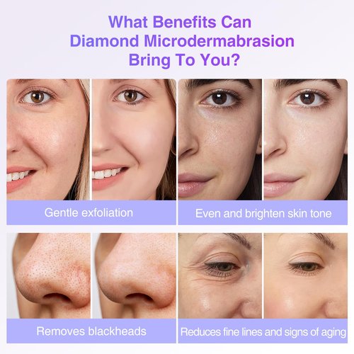 UNOISETION Diamond Microdermabrasion Tips Replacement for Diamond Tip Microdermabrasion Machine, 9PCs Facial Peel Diamond Microderm Tips for Microdermabrasion Device