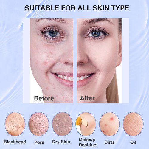 Silicone Face Scrubber, Waterproof Electric Facial Cleansing Brush for Men & Women, Rechargeable Face Scrubber with 5 Modes for Deep Cleansing, Exfoliating, Massage (Blue)