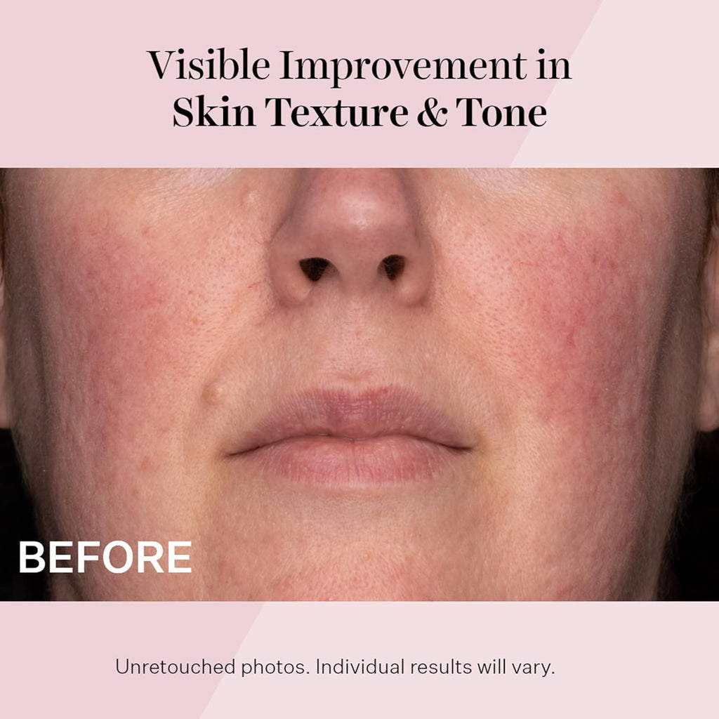 StriVectin Advanced Retinol Serum - Targets Visible Signs of Aging for Healthier Skin