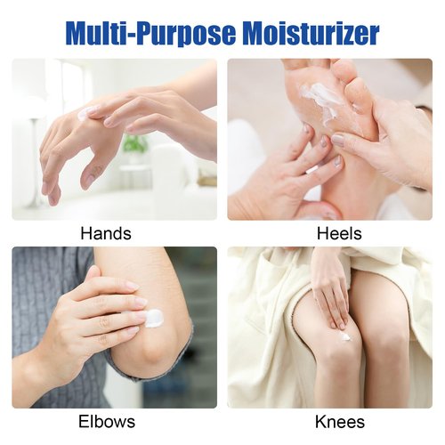 Urea Cream 60% plus 2% Salicylic Acid for Feet Maximum Strength - Lotion For Dry Cracked Feet Elbows Knees Heels Hands, Hydrates Foot Care for Softening and Moisturizing, Callus Remover 10.1oz