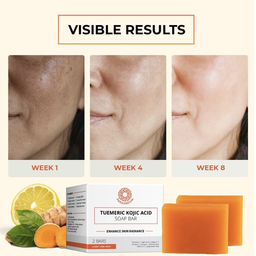 Kojic Acid Soap and Loofah Sponge Set: Soap Bar with Turmeric, Vitamin C, Retinol, Hyaluronic Acid, Vitamin E, Shea Butter, Olive Oil - 2 Pack Soap and 1 Pack Spooge