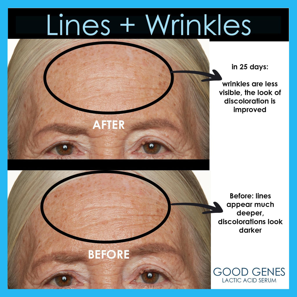 Sunday Riley Good Genes Lactic Acid Treatment Serum - All-in-One Anti-Aging Solution
