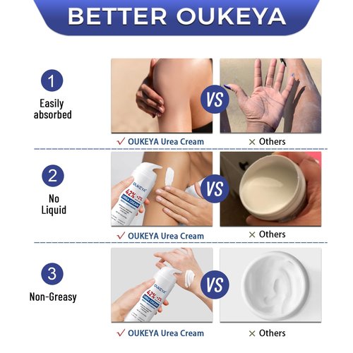 OUKEYA Urea Cream with Salicylic Acid for Dry, Rough Skin – Moisturiser for Feet, Heels, Hands & Elbows, 5.29 Oz