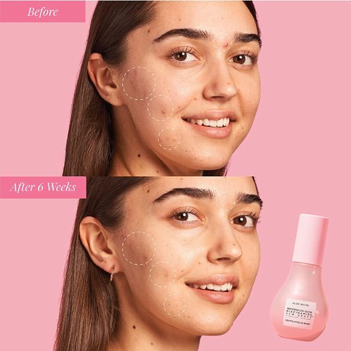 Glow Recipe Watermelon Niacinamide Dew Drops - Hydrating Face Serum & Primer | Travel Size (15ml)