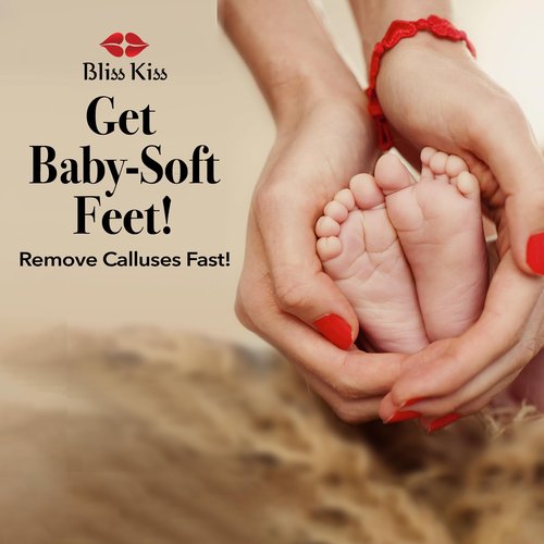 Bliss Kiss Callus Remover for Feet Nano Glass Pumice Stone for Feet, Hard Skin Foot File w/Easy Grip-No Slip Handle, Heel Scraper for Cracked Heels, Pedicure Tools for Feet, Foot Scraper