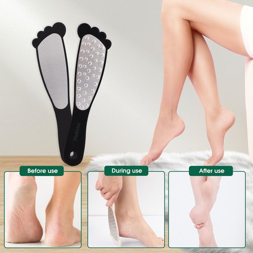 Hotosu 2 Sided Foot File Callus Remover Stainless Steel for Wet & Dry Skin – Professional Cheese Grater for Feet & Foot Rasp for Smooth Feet, Pedicure Tools for Feet, Gentle Foot Care at Home (Black)