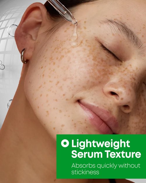 Nineless 10% Azelaic Acid Serum with Niacinamide & Snail Mucin - Redness Relief & Dark Spot Corrector for Face - Facial Serum for Acne-Prone, Oil Control & Pore Care 1.01 fl.oz