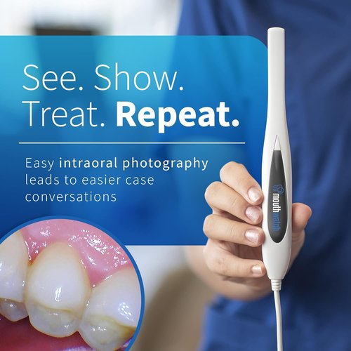 Intraoral Camera - Crystal Clear Images | Easy Single Button Operation, Lightweight & Ergonomic, 31g