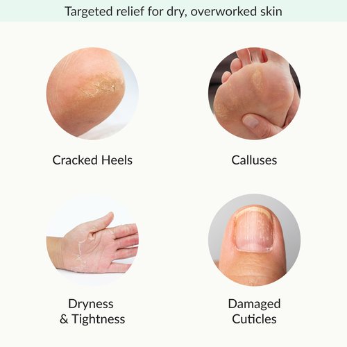 Epielle Relaxing & Nourishing Hand & Foot Masks, Soften Dry, Overworked Skin, Self Care Gifts for Women, Spa Kit, Easter Basket Stuffers, 6 Moisturizing Gloves & 6 Moisturizing Socks