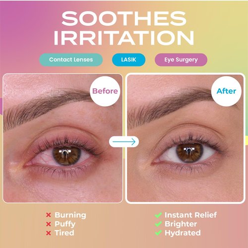 Body Restore Self Heating Warm Compress for Dry Eyes 5 Pack - Heated Eye Mask for Fast Relief, Birthday Gifts for Women, Men, Travel Essentials, Stye Eye Treatment, Eye Patch, Relaxation - Variety