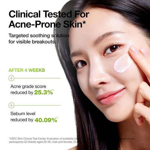 ANUA Azelaic Acid CICA Moisturizer - Lightweight Redness Relief for Acne Prone Skin | Fragrance Free, 3.38 fl oz