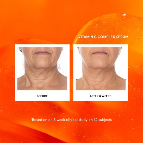 Naturium Vitamin C Complex Face Serum - Anti-Aging Treatment with Hyaluronic Acid & Vitamin E | 1 oz