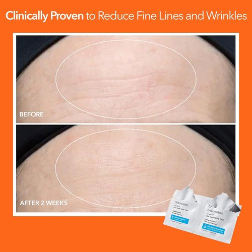 Dr. Dennis Gross Alpha Beta Ultra Gentle Daily Peel - Revitalize Dehydrated Skin | 30 Treatments