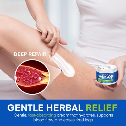 AOSORW Varicose & Spider Veins Cream – Natural Vein Treatment Leg Cream to Improve Circulation, Relieve Tired Legs & Swelling – Helps Reduce Appearance of Veins – 3.4 Fl Oz (Pack of 1)