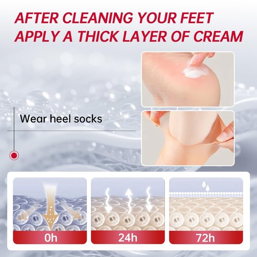 OCSINL Urea Cream 40 Percent for Feet Maximum Strength, with Heel Protectors, Foot Moisturizer Cream for Dry Cracked Heels Rough Dead Dry Skin Foot Callus Remover - 5.29 Oz