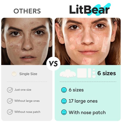 LitBear Large Pimple Patches for Face (6 Sizes 401 Counts), Big Hydrocolloid Acne Patches, XL Hydrocolloid Bandages for Body, Cheek, Forehead, Chin, Full Face, Back, Nose
