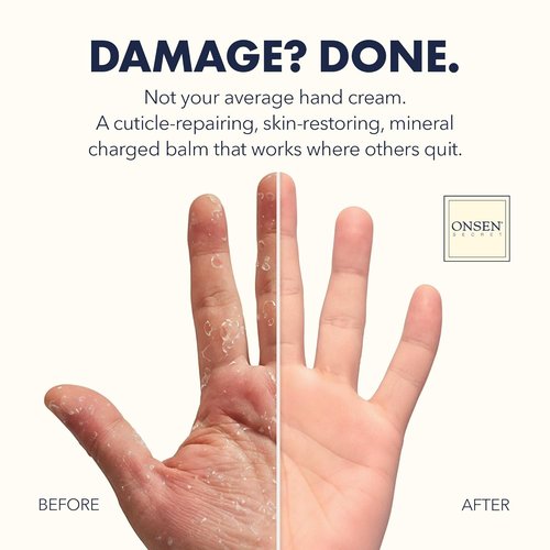Onsen Nail & Cuticle Rescue Kit - Strengthening Conditioner Serum, Repair Oil & Balm | Tsubaki, Shea Butter, Jojoba (15ml Serum + 10ml Oil + 32.5ml Cream)