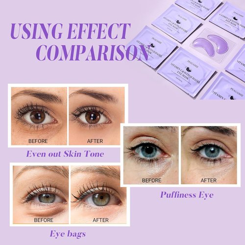 PEAUAMIE Under Eye Patches - Vitamin C & Witch Hazel Eye Mask for Dark Circles | 30 Pairs